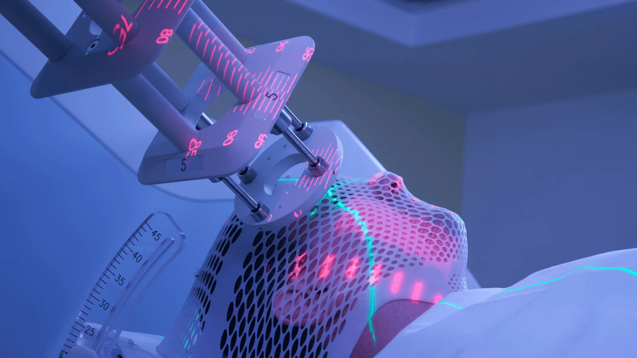radioterapia